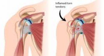 how to cure muscle recovery