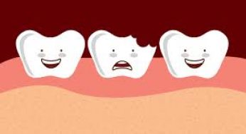 PREVENTING DENTAL INJURIES: STEPS TO BE TAKEN